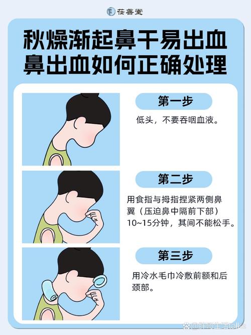 鼻部外伤处理要点