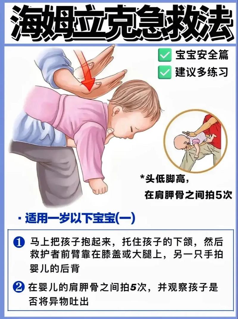 鱼刺卡喉海姆立克法?成人与儿童差异